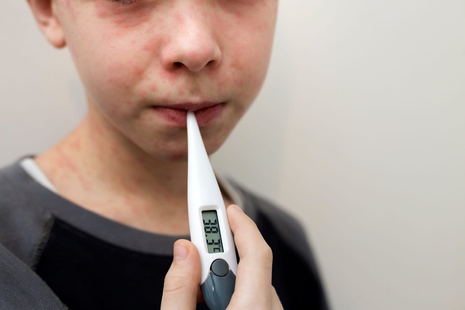 Portrait of sick sad boy child with thermometer having fever suffering from measles